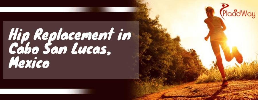 Hip Replacement in Cabo San Lucas, Mexico
